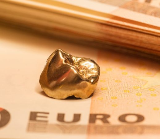 Gold als Anlage in der Zahnarztpraxis: Chancen, Risiken und steuerliche Aspekte